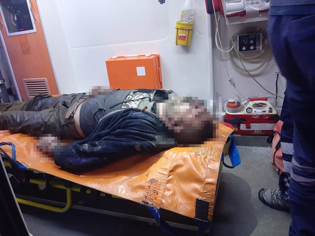 Elinde sigarayla uyuyakalınca ölümden döndü 7